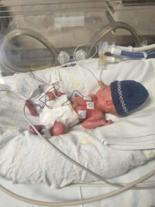 Premature Casey mum’s ‘little diamond’