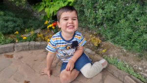 Child’s foot amputated in lawnmower accident